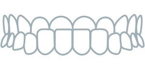 Houston Orthodontic Specialists repairs dental underbite issues