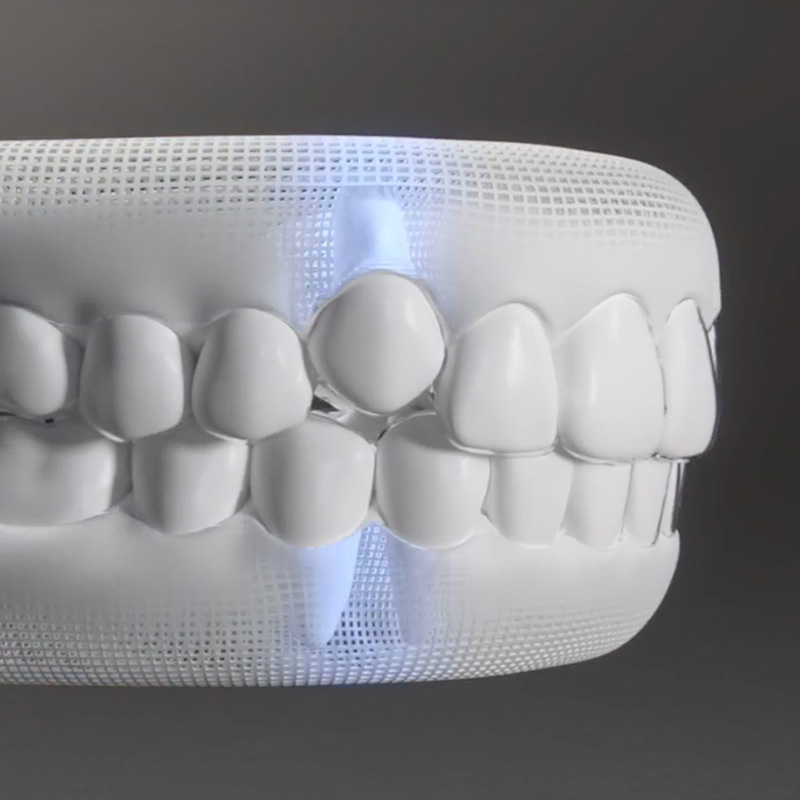 invisalign-teen-video