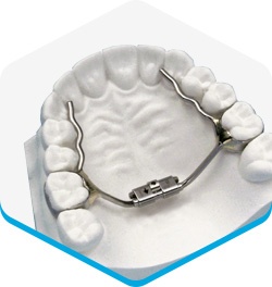 palatal expander is a common appliance for dental treatment