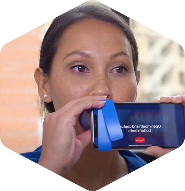 grin-remote-monitoring-video