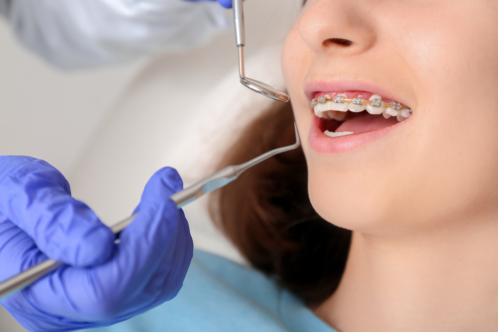 Teenage-Girl-With-Dental-Braces-Visiting-Orthodontist-In-Clinic