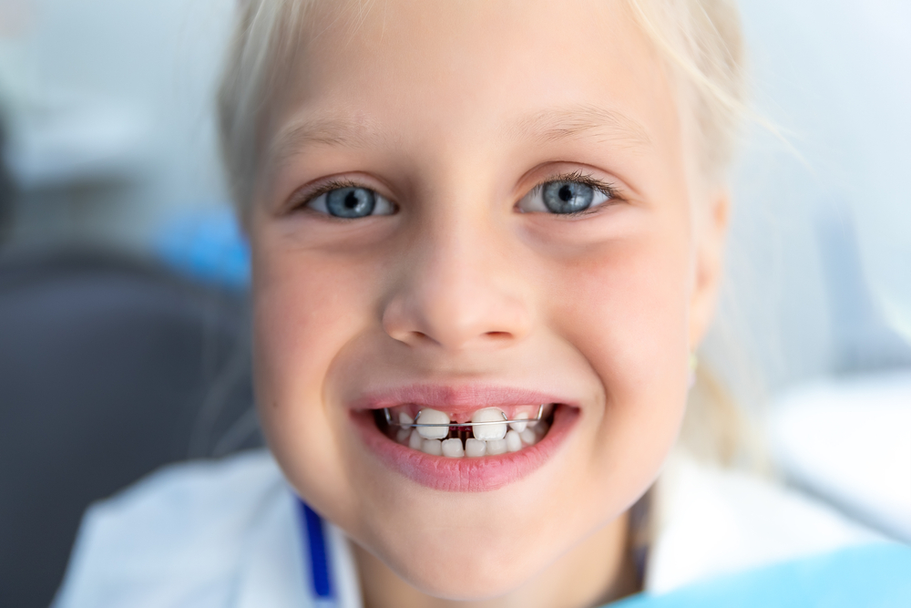 Kid wearing dental braces