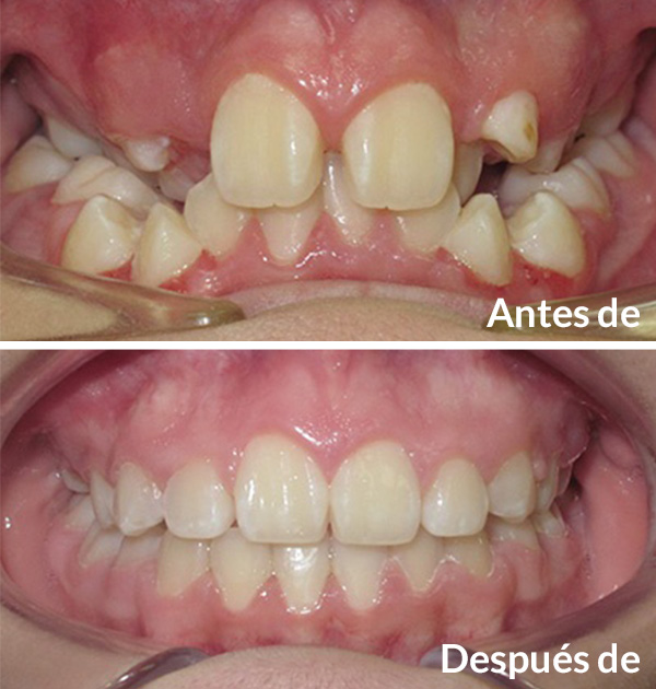 before after 2
